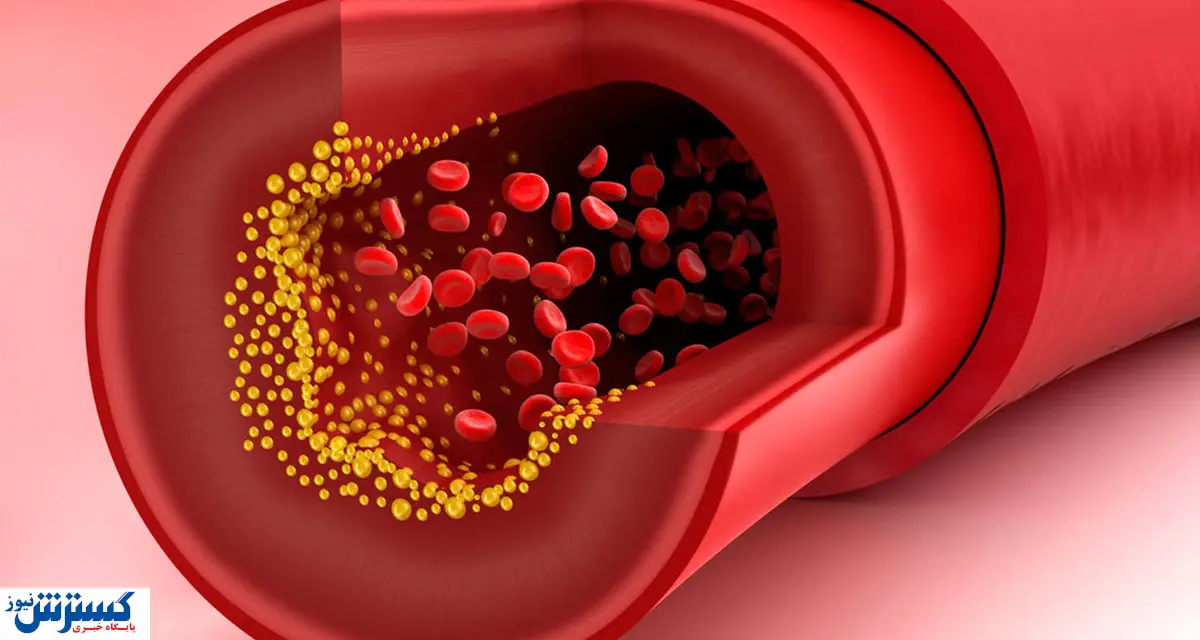 تری گلیسرید و چند روش طلایی برای کاهش آن