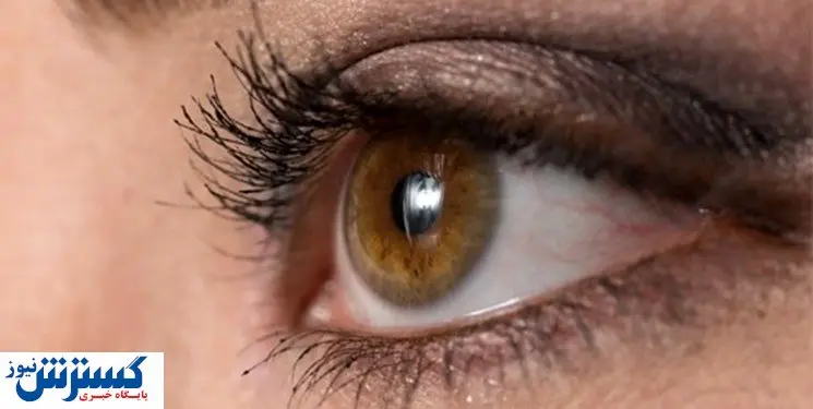 راه درمان آبریزش «چشم» در بهار