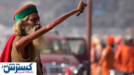 دست راست این مرد جهانی شد + عکس