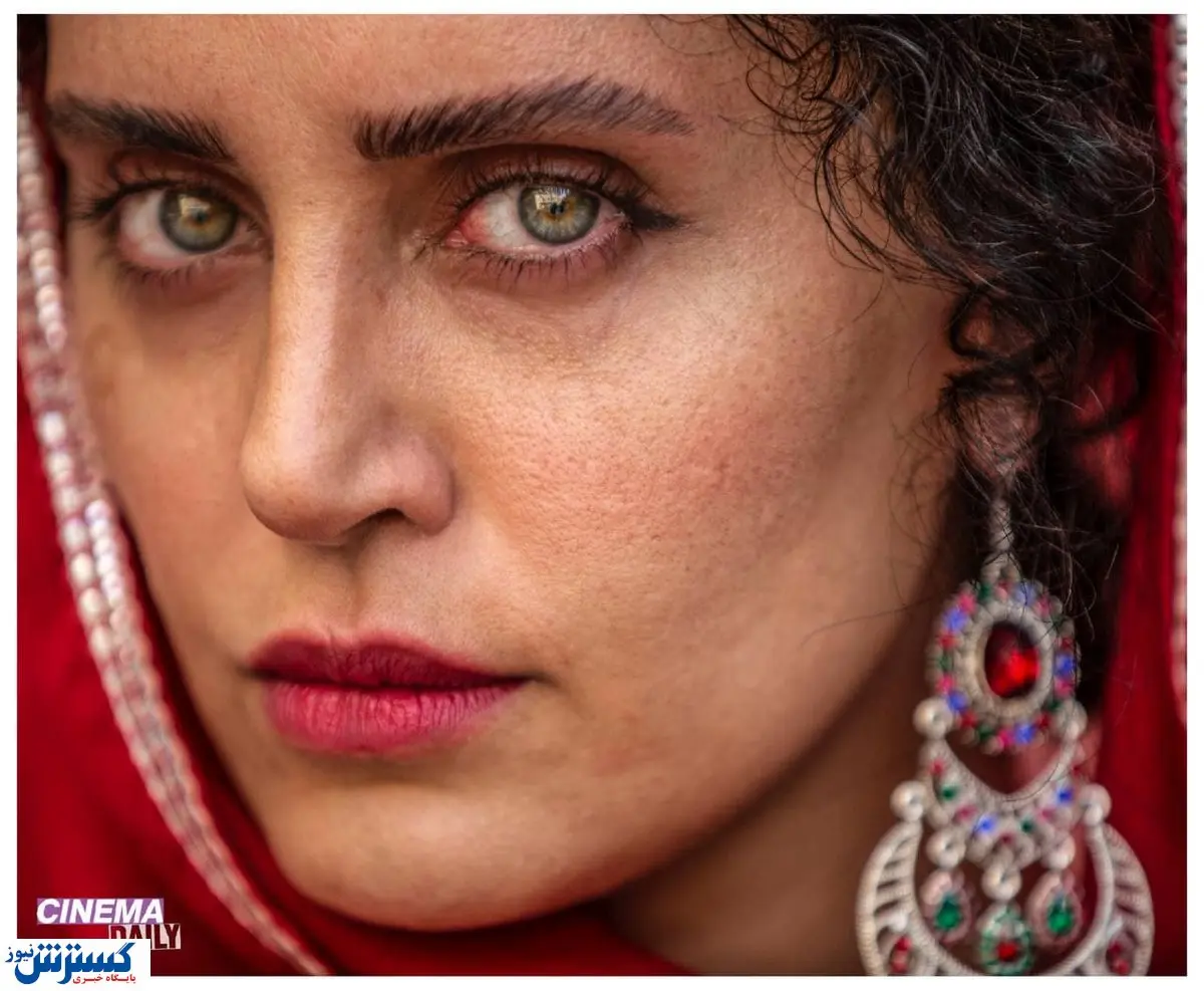 الناز شاکر دوست با چهره زخمی