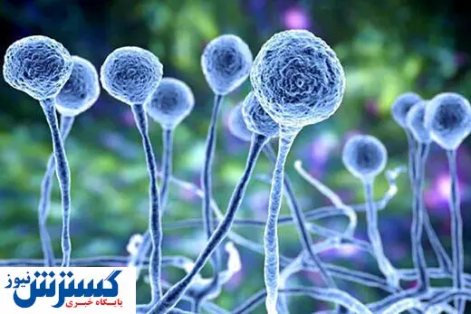 بیماری قارچ سیاه با چه علائمی آغاز می شود؟