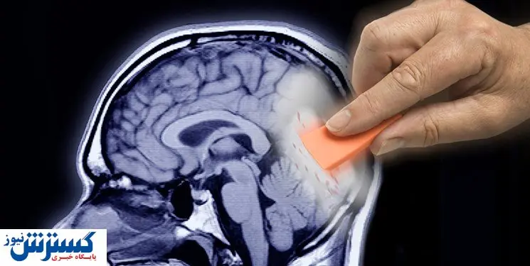 کشف عامل ابتلا به آلزایمر