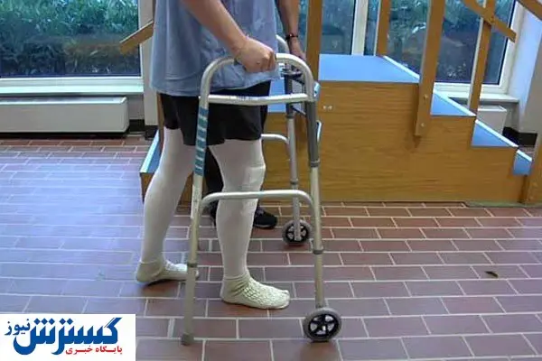 چند روز بعد از عمل زانو میتوان راه رفت؟