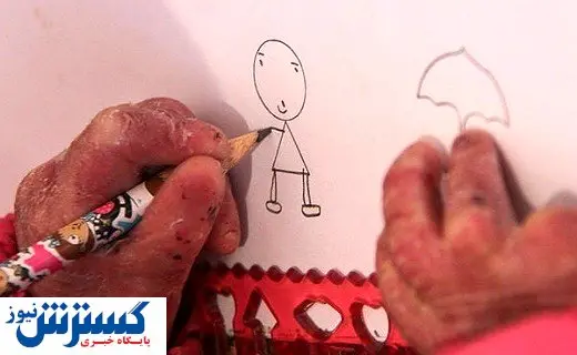 التیام بخشی برای زخم بیماران پروانه ای + جزئیات