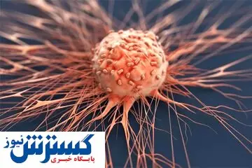 خوراکی های مفید برای پیشگیری از سرطان چشم