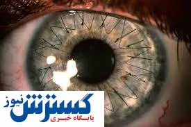 کمک سلولهای بنیادی به پایان نابینایی