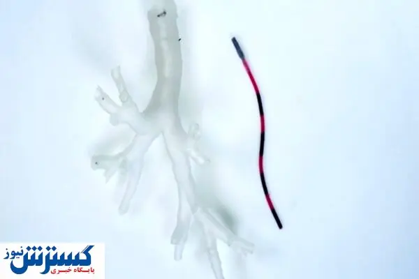 ربات انعطاف پذیر به کمک علم پزشکی در درمان سرطان ریه آمد