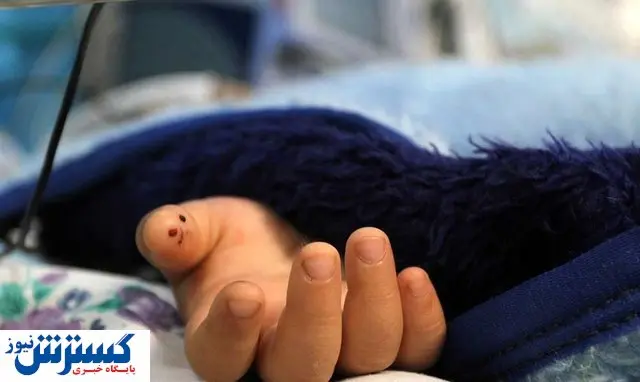 ابتلای نوزادان به بیماری که هیچکس فکرش را هم نمیکند