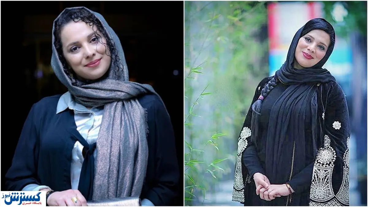 چهره جدید خانم بازیگر همه را شوکه کرد! | عمل جراحی یا تزریق ژل؟ +عکس