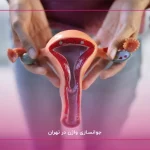 جوانسازی واژن در تهران