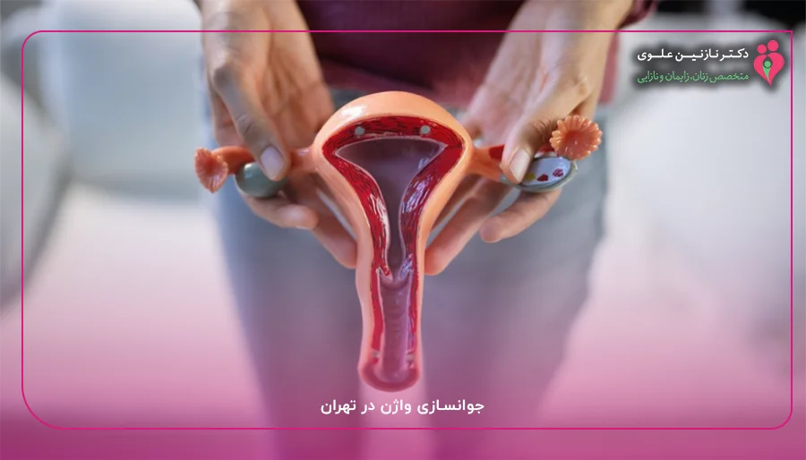 جوانسازی واژن در تهران